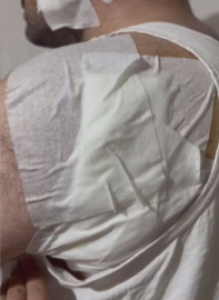 İstanbul- Esenyurt'ta eski kiracı ev sahibini bıçakla yaraladı