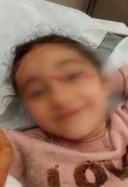 İstanbul - Eyupsultan'da okuldan eve dönen 6 yaşındaki çocuğa sokak köpekleri saldırdı